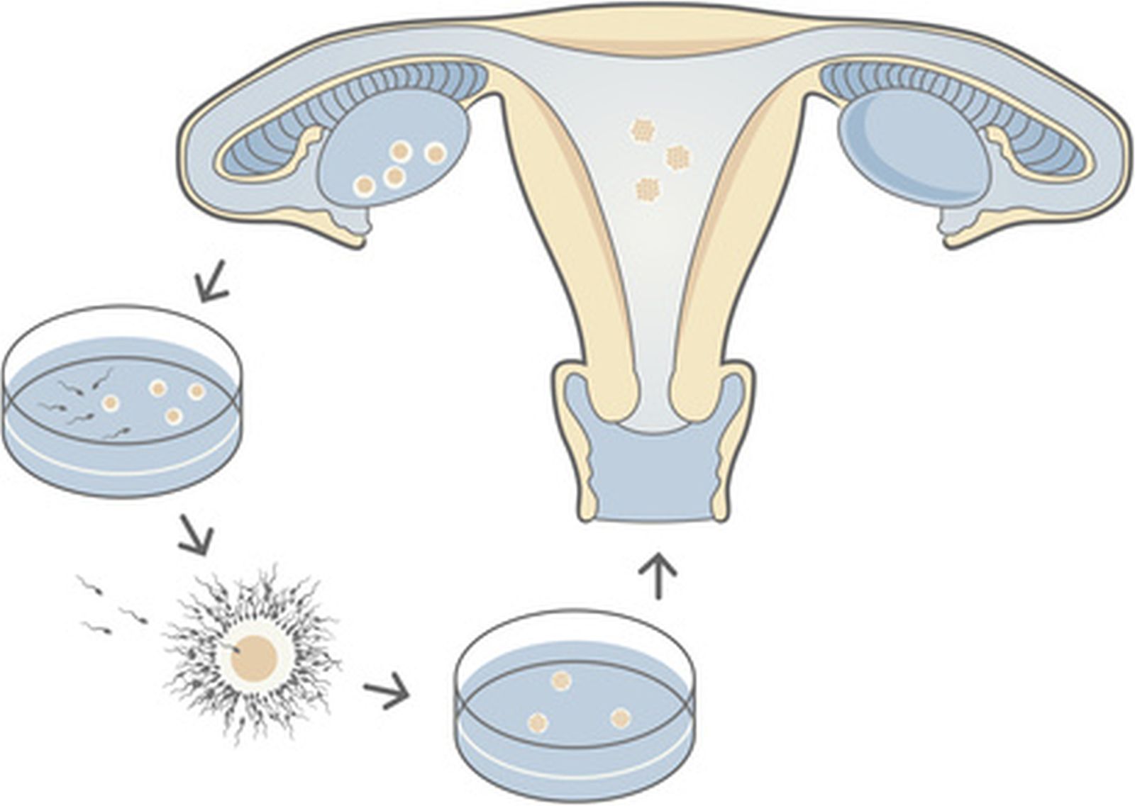 Diagram Of In-vitro Fertilization - Медицински Център "Афродита"